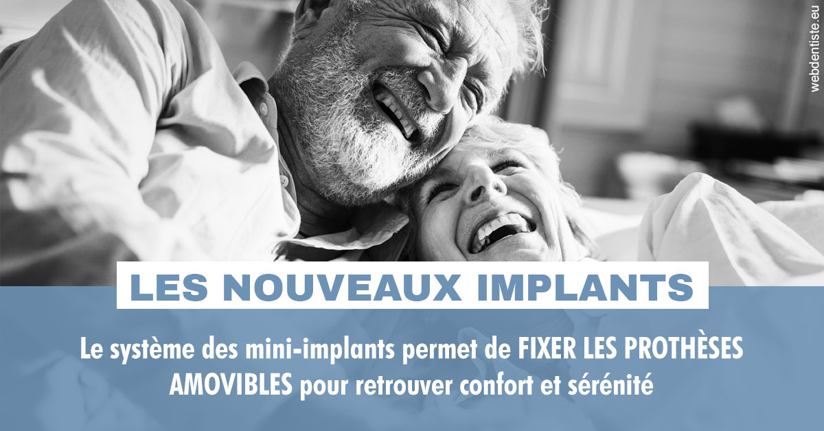 https://dr-aouizerat-david.chirurgiens-dentistes.fr/Les nouveaux implants 2