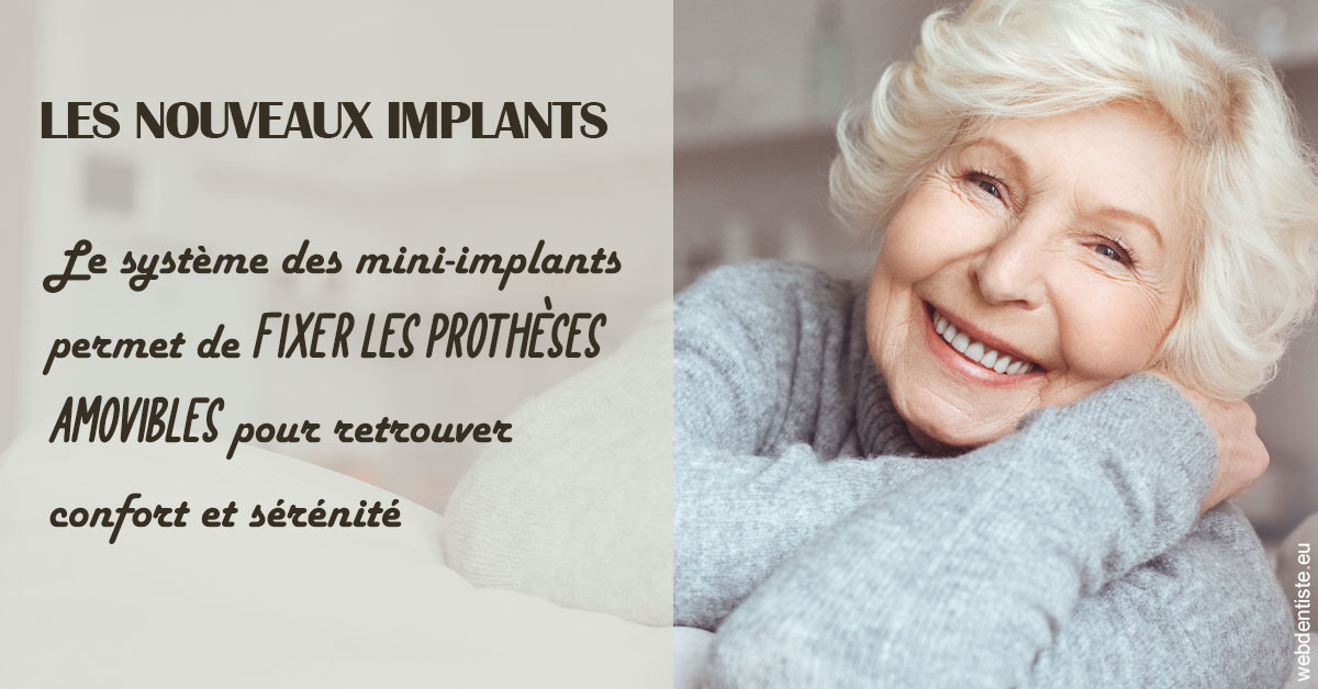 https://dr-aouizerat-david.chirurgiens-dentistes.fr/Les nouveaux implants 1