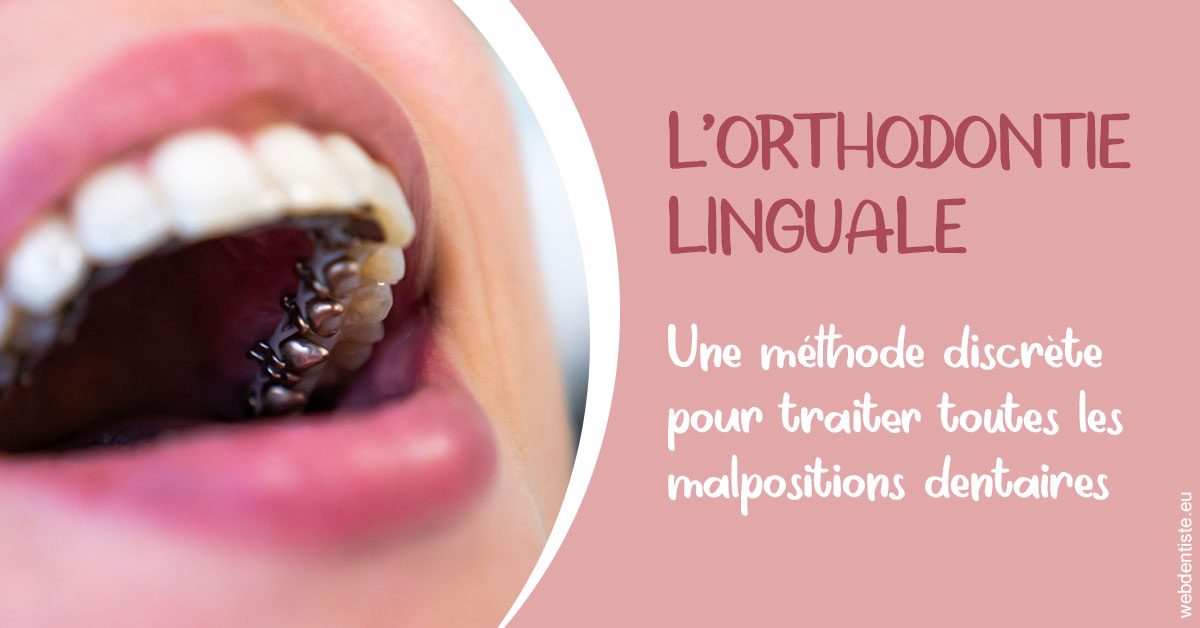 https://dr-aouizerat-david.chirurgiens-dentistes.fr/L'orthodontie linguale 2