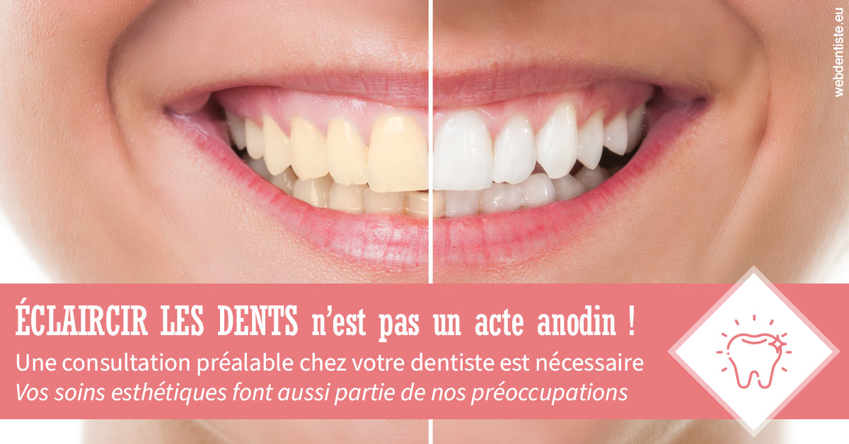 https://dr-aouizerat-david.chirurgiens-dentistes.fr/Eclaircir les dents 1