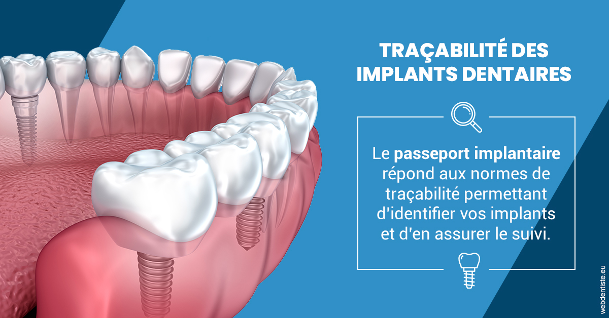 https://dr-aouizerat-david.chirurgiens-dentistes.fr/T2 2023 - Traçabilité des implants 1