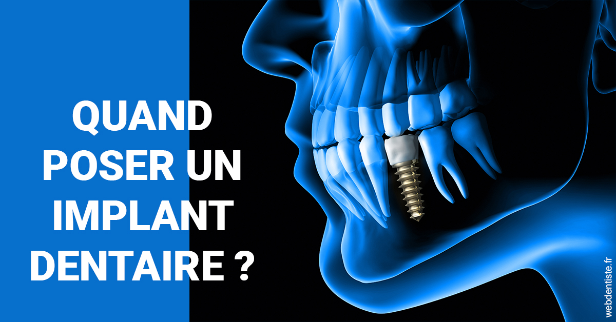 https://dr-aouizerat-david.chirurgiens-dentistes.fr/Les implants 1