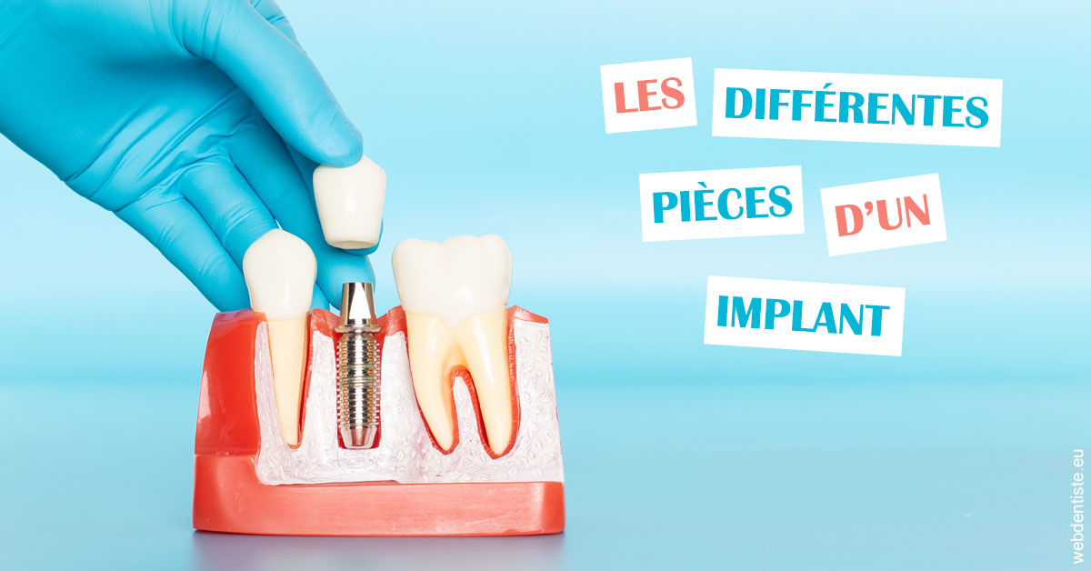 https://dr-aouizerat-david.chirurgiens-dentistes.fr/Les différentes pièces d’un implant 2