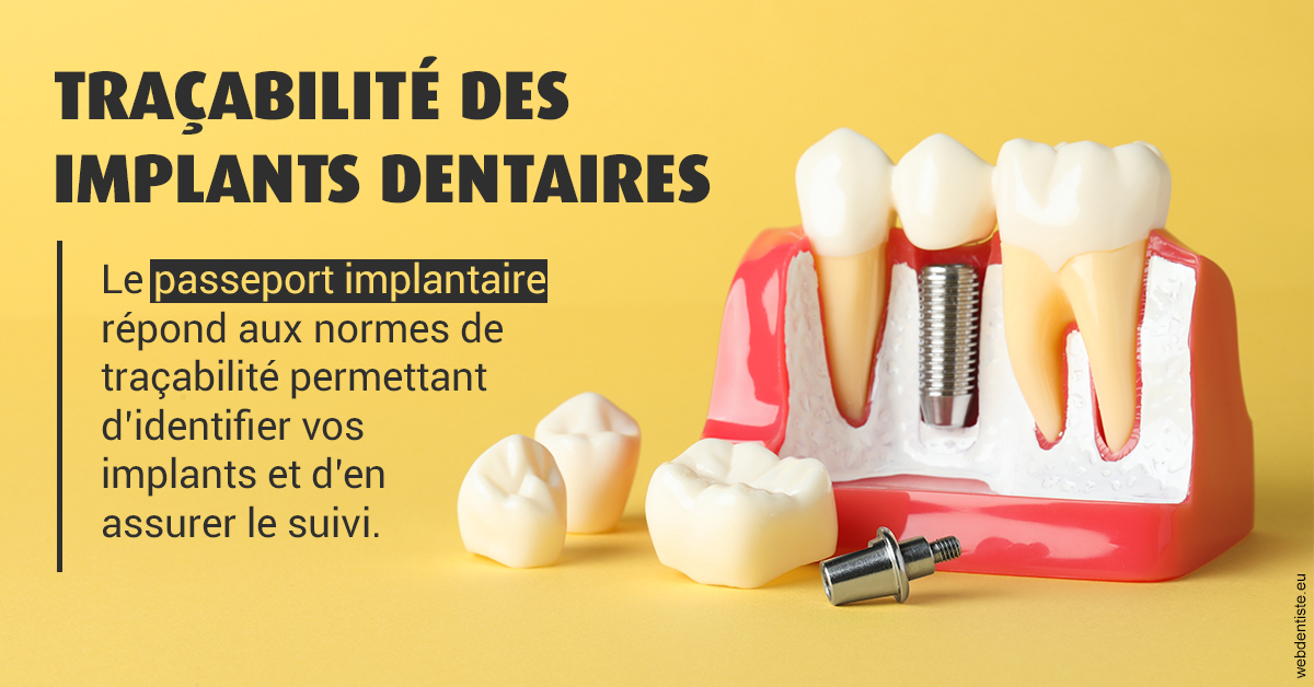 https://dr-aouizerat-david.chirurgiens-dentistes.fr/T2 2023 - Traçabilité des implants 2