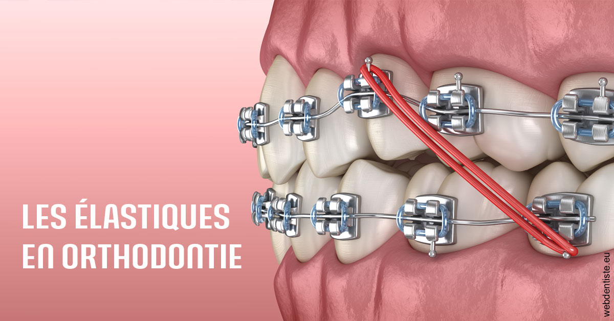 https://dr-aouizerat-david.chirurgiens-dentistes.fr/Elastiques orthodontie 2