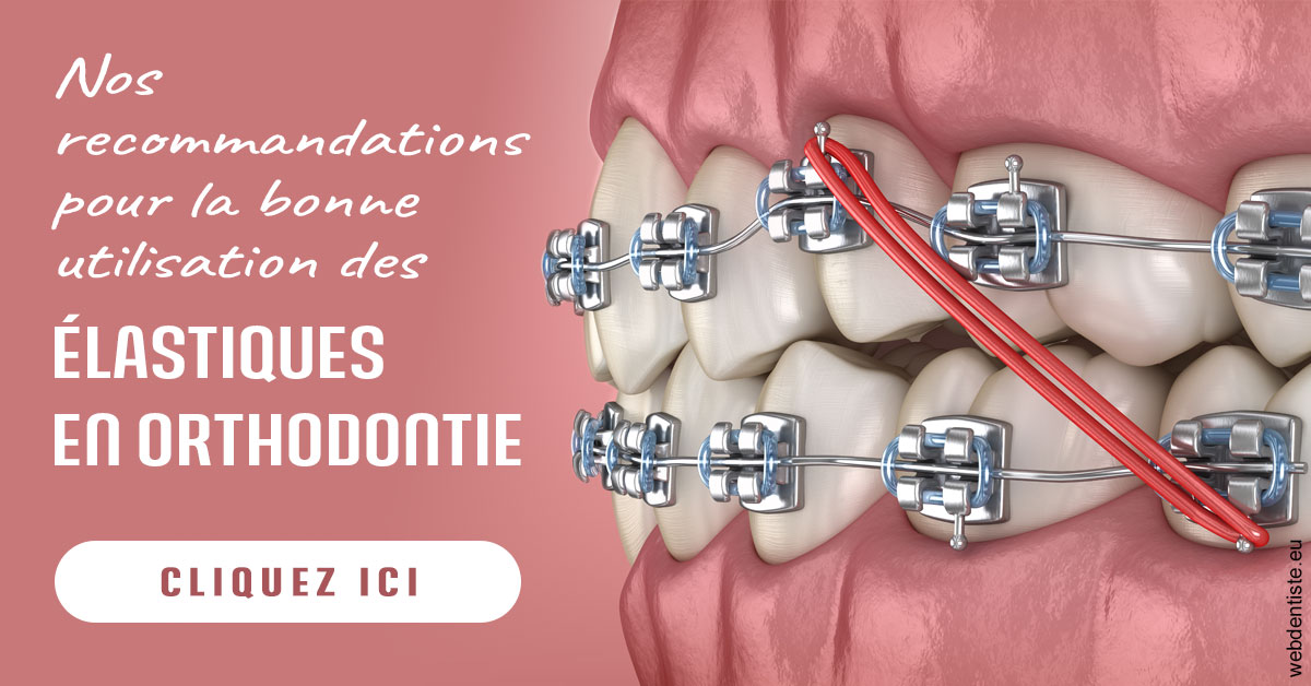 https://dr-aouizerat-david.chirurgiens-dentistes.fr/Elastiques orthodontie 2
